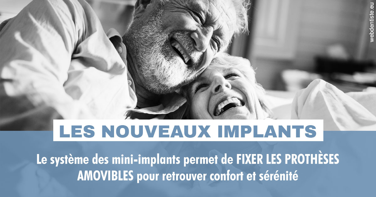 https://www.cabinetdentairedustade.fr/Les nouveaux implants 2