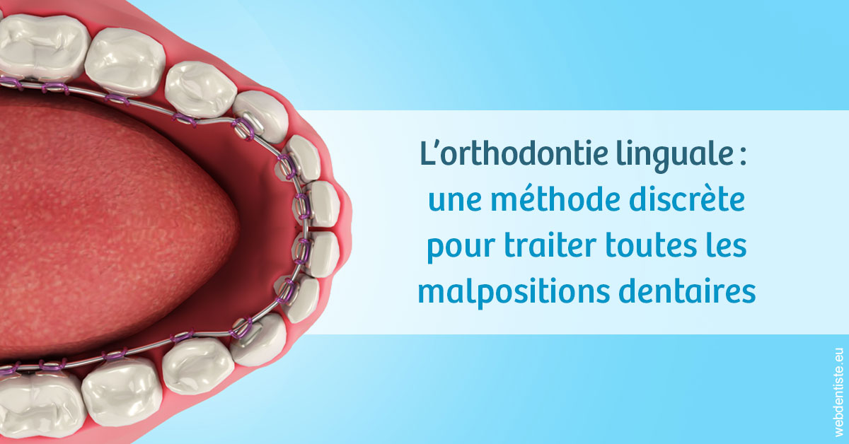 https://www.cabinetdentairedustade.fr/L'orthodontie linguale 1