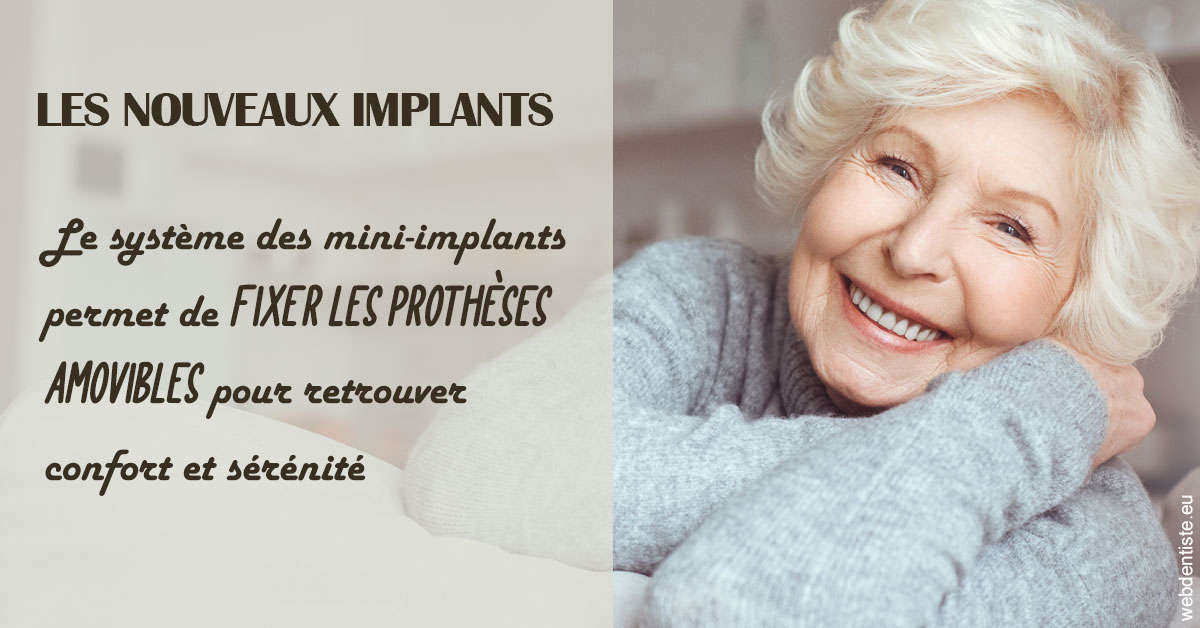 https://www.cabinetdentairedustade.fr/Les nouveaux implants 1