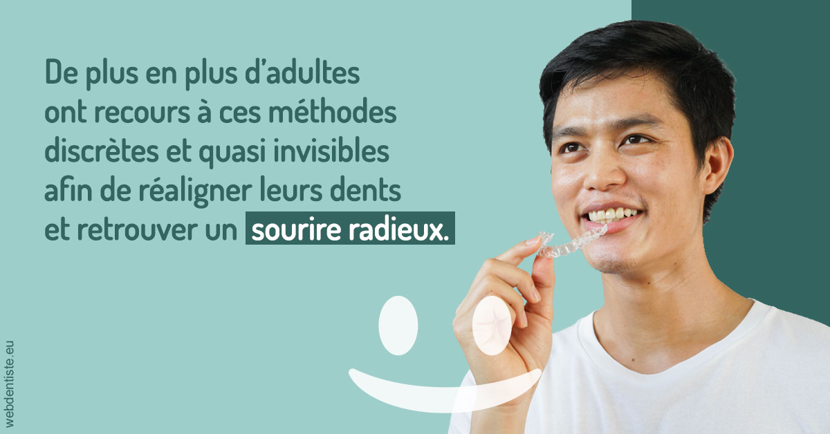https://www.cabinetdentairedustade.fr/Gouttières sourire radieux 2