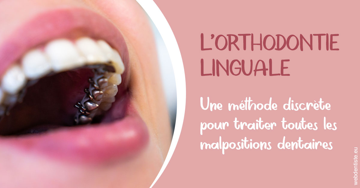 https://www.cabinetdentairedustade.fr/L'orthodontie linguale 2