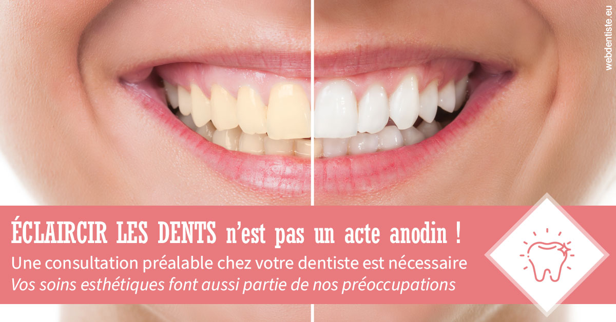 https://www.cabinetdentairedustade.fr/Eclaircir les dents 1