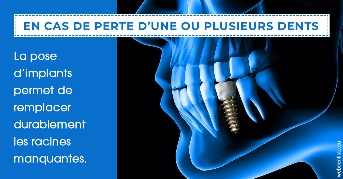 https://www.cabinetdentairedustade.fr/2024 T1 - Implants 01