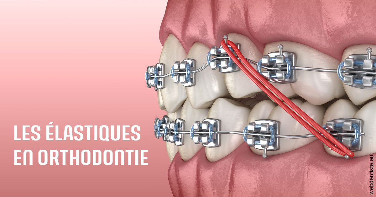 https://www.cabinetdentairedustade.fr/Elastiques orthodontie 2