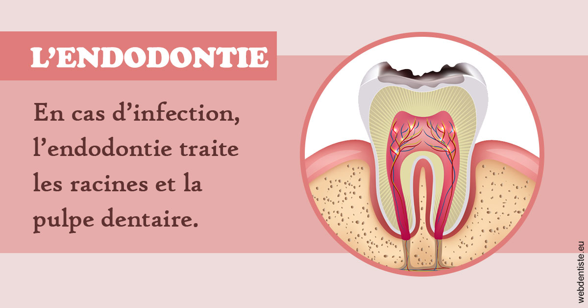 https://www.cabinetdentairedustade.fr/L'endodontie 2