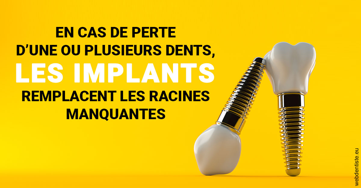 https://www.cabinetdentairedustade.fr/Les implants 2